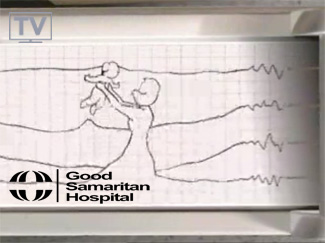 Good Samaritan Hospital TV Spot
